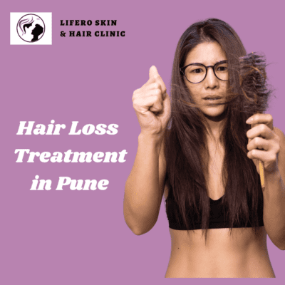 Hair loss treatment