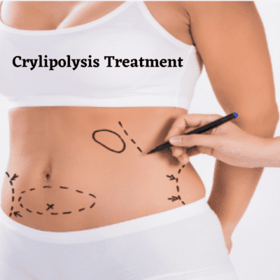 Crylipolysis Treatment