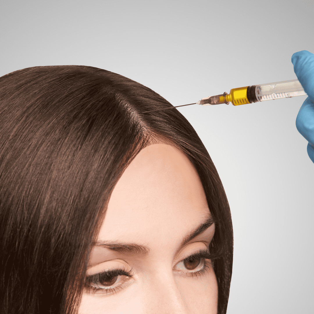 prp hair loss treatment