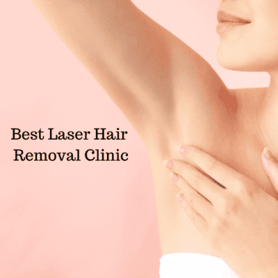 Laser hair removal treatment